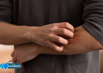 سرما و پوست