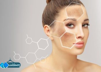 رفع تیرگی پوست صورت