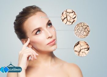 گیاهان مفید برای پوست خشک